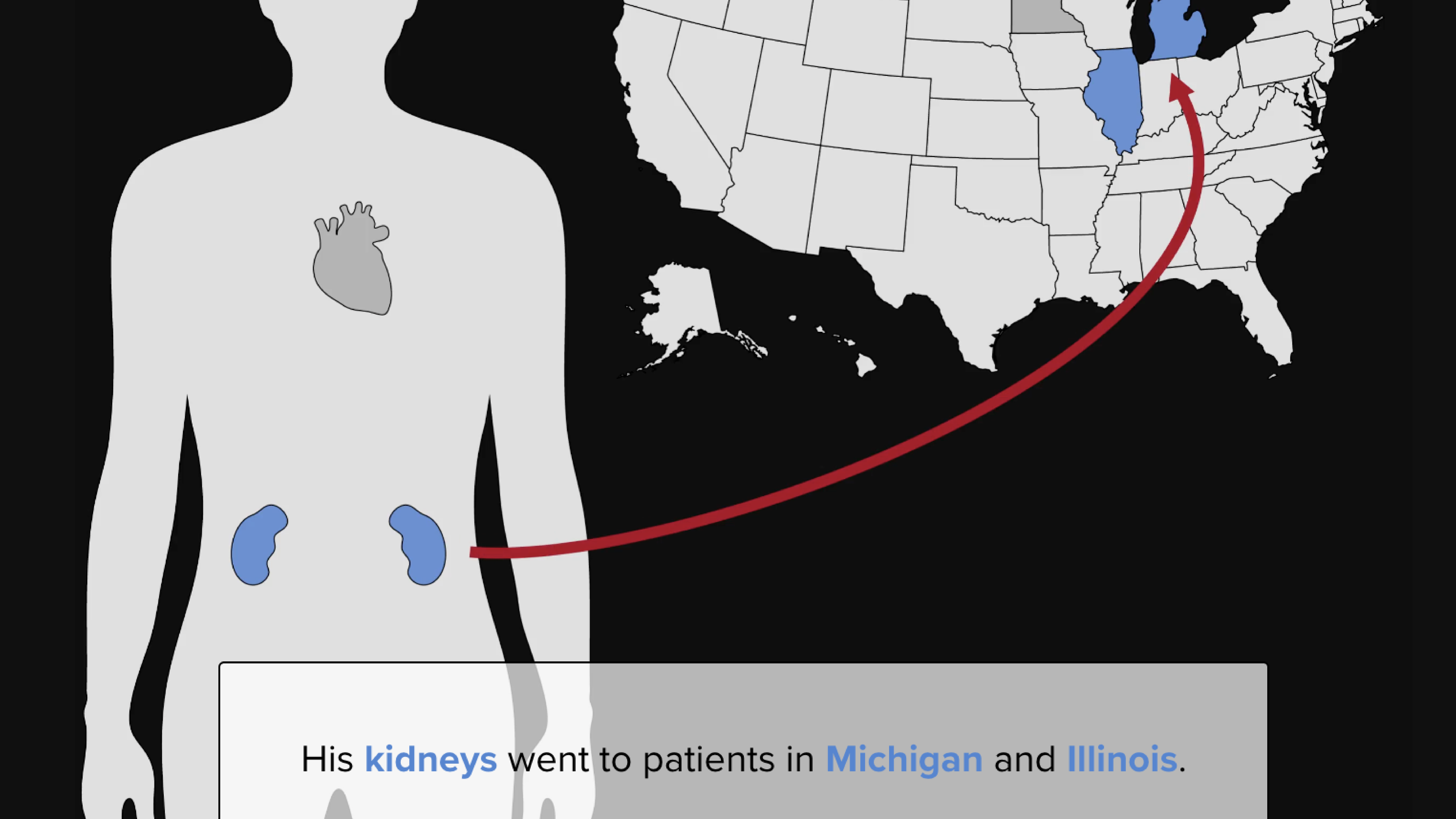 Unused donated organs